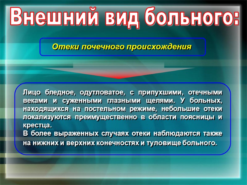 Внешний вид больного: Отеки почечного происхождения  Лицо бледное, одутловатое, с припухшими, отечными веками